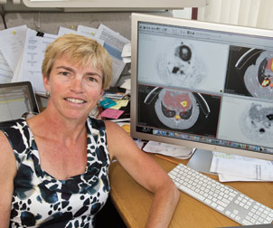 CVR researcher Joanne Flynn, a professor of microbiology and molecular genetics, and her colleagues have developed imaging technology to better understand how tuberculosis (TB) responds to drugs. The hallmark of TB is the presence of large, inflammatory clumps of bacterial and immune cells, called granulomas. Flynn, using a $12 million grant from the Bill and Melinda Gates Foundation, installed one of the world’s first hybrid positron emission tomography/computed tomography (PET/CT) scanners, enabling her to watch the granulomas in real time and to see how they respond to different drugs. Flynn’s serial imaging technology represents a major breakthrough in TB imaging and will likely lead to quicker advances in vaccine and drug development. 