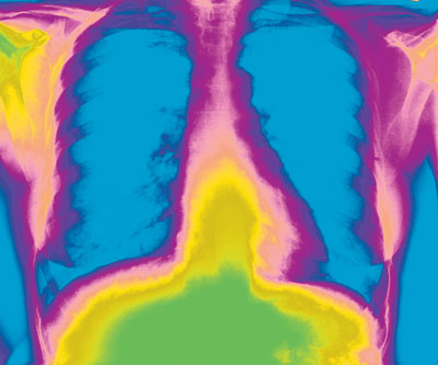 lungs.jpg